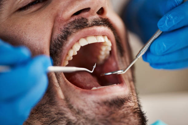 Best Emergency Tooth Extraction in Honsville, GA